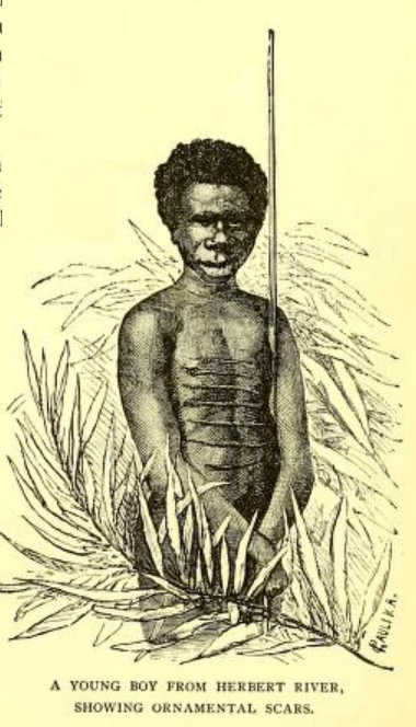 A young boy from Herbert River showing ornamental scars